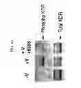 Fig. 15 - KDR and VEGF/KDR binding peptides and their use in diagnosis and therapy