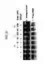 Fig. 18 - KDR and VEGF/KDR binding peptides and their use in diagnosis and therapy