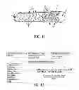 Fig. 03 - COMPOSITIONS AND METHODS FOR TREATING OR PREVENTING DISEASES OF BODY PASSAGEWAYS
