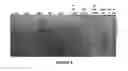 Fig. 09 - HIGH MOLECULAR WEIGHT HEPAROSAN POLYMERS AND METHODS OF PRODUCTION AND USE THEREOF