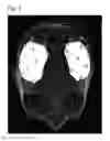 Fig. 02 - BRAIN FUNCTION IMPROVING AGENT