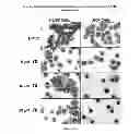 Fig. 13 - Kinase inhibitors and methods of use thereof