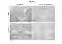 Fig. 09 - Methods of use of soluble CD24 for therapy of rheumatoid arthritis