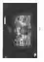 Fig. 02 - Method of dose comparison for in vivo dosimetry
