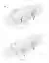 Fig. 08 - Device for restraint of patients on a table