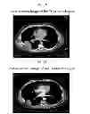 Fig. 04 - SYSTEMS AND METHODS FOR DELIVERING A THERAPEUTIC AGENT