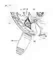 Fig. 09 - Methods and devices for treating primary headache