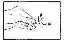 Fig. 01 - Adjustable pessary device and method