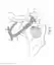 Fig. 11 - Incontinence treatment device
