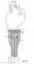 Fig. 02 - Cardiac treatment system and method