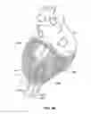 Fig. 09 - Cardiac treatment system and method