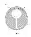 Fig. 05 - Cardiac treatment system and method