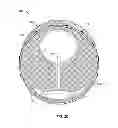 Fig. 06 - Cardiac treatment system and method