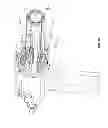 Fig. 23 - Cardiac treatment system and method