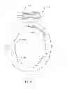 Fig. 25 - Cardiac treatment system and method