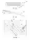 Fig. 31 - Cardiac treatment system and method