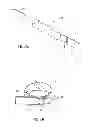 Fig. 04 - GASTRIC BAND