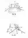 Fig. 08 - GASTRIC BAND