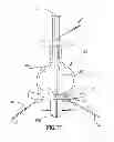 Fig. 09 - GASTRIC BAND