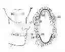 Fig. 01 - DEVICE FOR CORRECTING SUNKEN CHEEKS