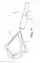 Fig. 14 - ENDOSCOPIC INSTRUMENT HAVING REDUCED DIAMETER FLEXIBLE SHAFT