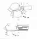 Fig. 16 - ENDOSCOPIC INSTRUMENT HAVING REDUCED DIAMETER FLEXIBLE SHAFT