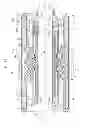 Fig. 05 - Assist assembly for propulsion of endoscope
