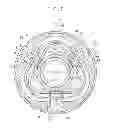 Fig. 06 - Assist assembly for propulsion of endoscope