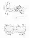 Fig. 02 - System and methods for treating ear disorders
