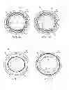 Fig. 03 - System and methods for treating ear disorders