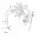 Fig. 10 - Vaginal manipulator with an adjustable length head
