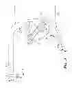 Fig. 13 - Vaginal manipulator with an adjustable length head