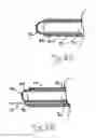 Fig. 07 - Apparatus and methods for performing brain surgery