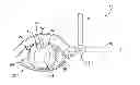 Fig. 01 - IRRIGATING AND ILLUMINATING SURGICAL SYSTEM AND RELATED METHODS
