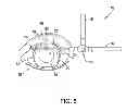 Fig. 06 - IRRIGATING AND ILLUMINATING SURGICAL SYSTEM AND RELATED METHODS