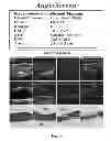 Fig. 04 - Systems and Method for Health Screening For Vascular Disease