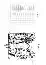 Fig. 04 - METHODS AND SYSTEMS OF AIMING SENSOR(S) FOR MEASURING CARDIAC PARAMETERS