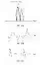 Fig. 11 - METHODS AND SYSTEMS OF AIMING SENSOR(S) FOR MEASURING CARDIAC PARAMETERS