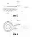 Fig. 10 - Microelectrodes in an ophthalmic electrochemical sensor