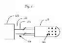 Fig. 02 - DBS and heart electrical stimulation and measurements with multiple electrodes