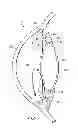 Fig. 02 - DEVICES, SYSTEMS, AND METHODS FOR INTRAOCULAR MEASUREMENTS