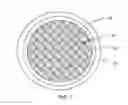 Fig. 02 - Image-Guided Radiotherapy For Internal Tumor Boost
