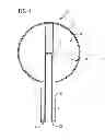 Fig. 05 - Balloon catheter and applicator with balloon catheter