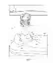 Fig. 03 - Laser Guidance System for Interventions