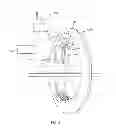 Fig. 04 - Laser Guidance System for Interventions