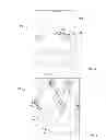 Fig. 05 - Laser Guidance System for Interventions