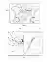 Fig. 06 - Laser Guidance System for Interventions