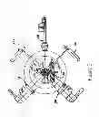 Fig. 03 - Frameless radiosurgery treatment system and method