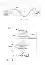 Fig. 08 - Frameless radiosurgery treatment system and method