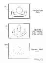 Fig. 13 - Frameless radiosurgery treatment system and method